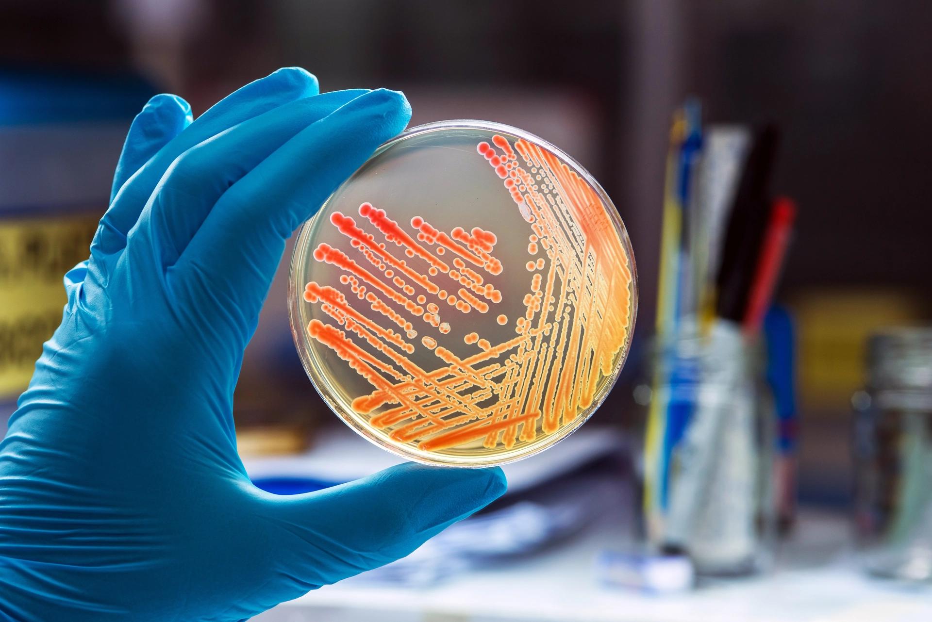 What is Bacterial Infections?