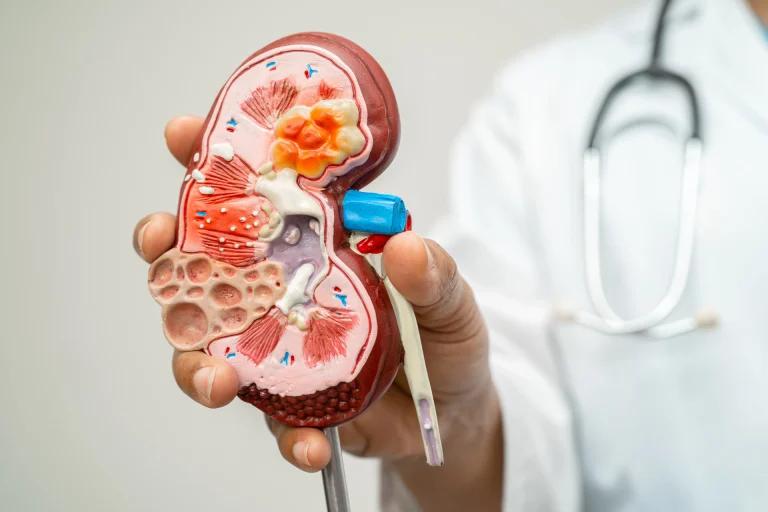 What is Chronic Kidney Disease?