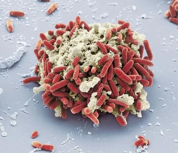 Microscopic view of a cluster of bacteria with red rod-shaped cells on a grey surface, potentially indicating E. coli infection.