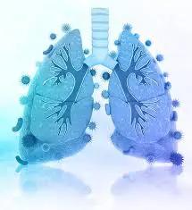 Medical illustration of human lungs with visible bronchi and surrounding representations of bacteria and viruses, showcasing how long it can take for conditions like asbestosis to develop.