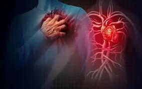 Illustration showing a person clutching their chest in pain, with an anatomical representation of a heart and blood vessels highlighted, depicting symptoms of unstable angina.
