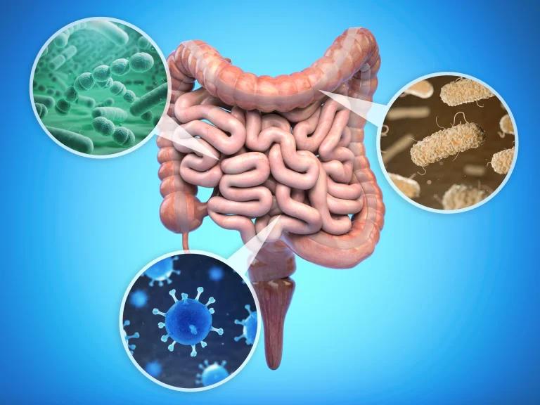What is Intestinal parasite infections?