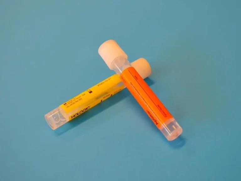 Two medical sample vials with white caps and colored labels, one yellow and one orange, are placed against a blue background, ready for analysis to determine potential causes of E. coli in urine related to urinary tract infections.