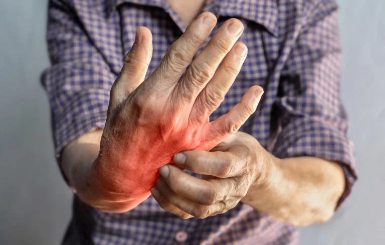 What is Rheumatoid Arthritis?