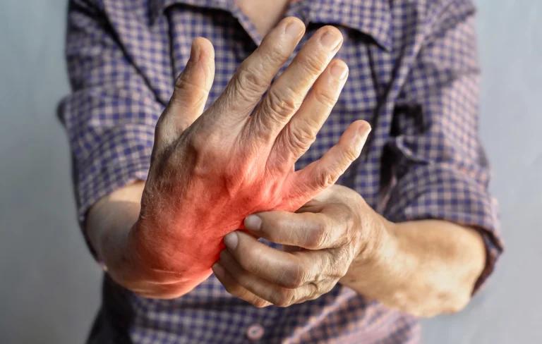 What is Rheumatoid Arthritis?