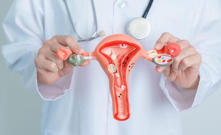 Doctor holding a model of the female reproductive system, illustrating the symptoms of cervical cancer