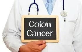 Doctor holding a sign which says colon cancer