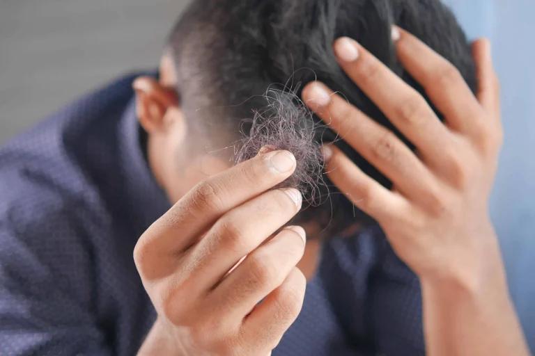 What you need to be aware of when considering treatment with finasteride