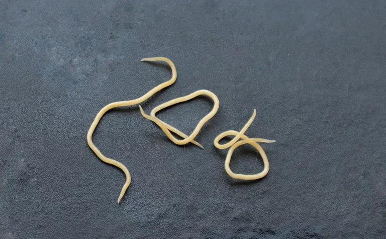 Image of what threadworms look like
